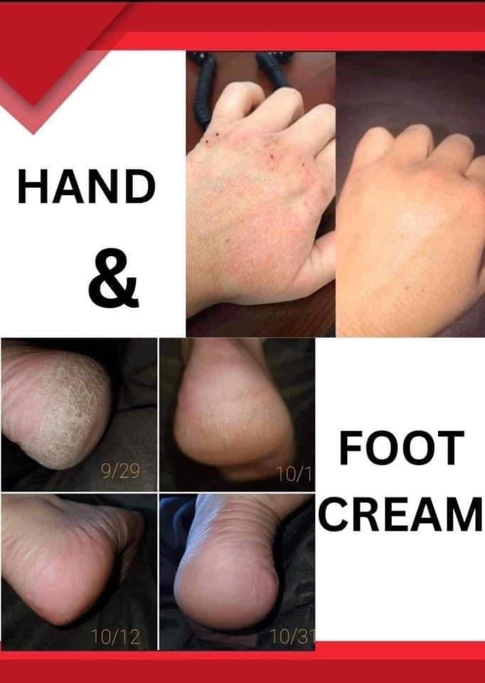 Foot Cream